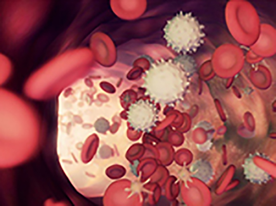 Infekcja COVID-19 imitująca ostrą białaczkę promielocytową